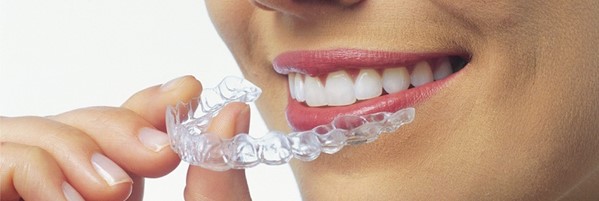 invisalign.jpg